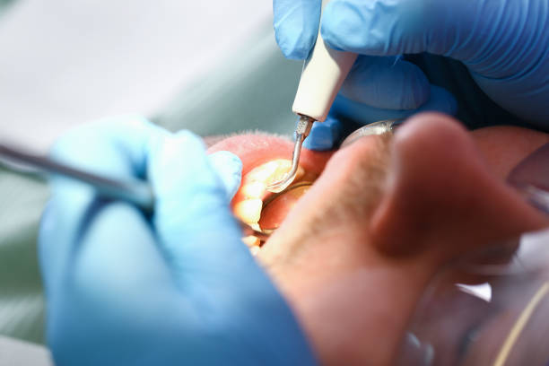 Best Teeth Whitening  in Vienna, GA